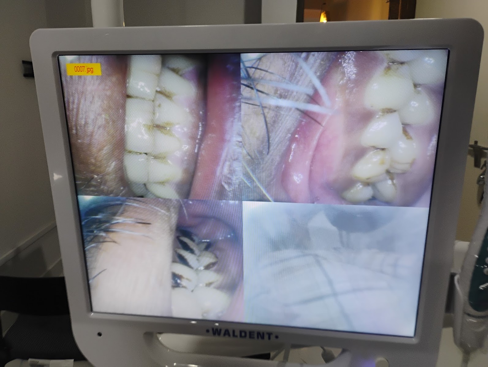 Real high-definition consultation and operatory suite at ORIS Speciality Dentistry
